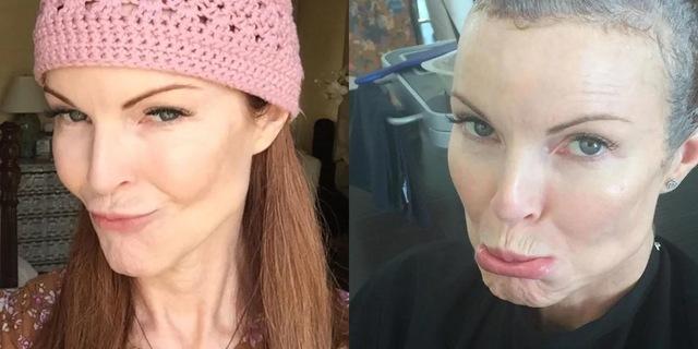 In 2019, Marcia bravely revealed that she had successfully battled anal cancer, inspiring others with her openness about her health journey